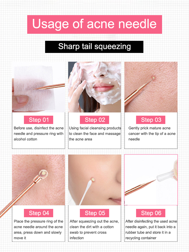 Средство для удаления угрей, и – обзор и цена Luxury Skincare Acne
